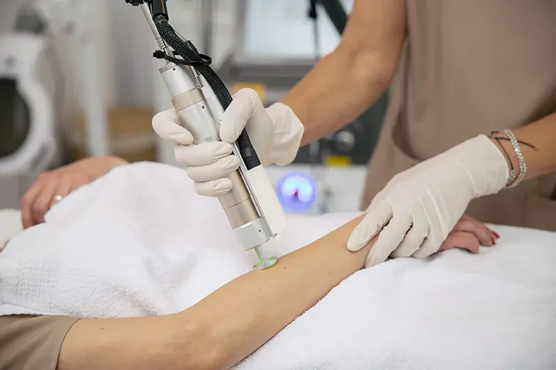 Epilare definitivă cu Laser Alexandrite – cel mai performant aparat