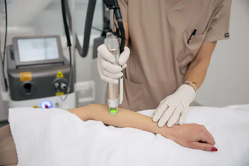 Procedură de epilare laser Alexandrite realizată cu atenție la Noua Clinic București