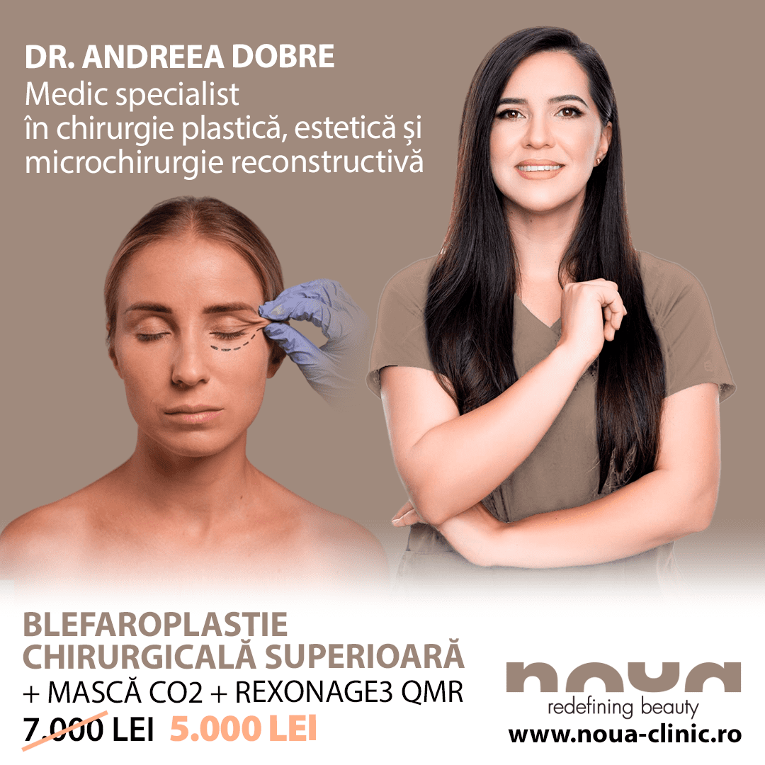 noua clinic blefaroplastie dr andreea dobre